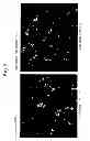 Fig. 06 - SKIN ACTIVATION BY ACCELERATION OF PDGF-BB ACTIVITY