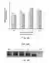 Fig. 05 - Method of treating Gaucher disease