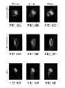 Fig. 07 - Method of treating Gaucher disease