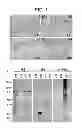 Fig. 02 - Detection of Neurodegenerative Disease