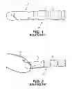 Fig. 02 - INSTRUMENT TIP HAVING WIRE RETENTION SLOT