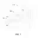 Fig. 02 - Needle positioning apparatus and method