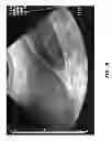 Fig. 09 - SYSTEMS AND METHODS FOR COMPUTERIZED ULTRASOUND IMAGE INTERPRETATION AND LABELING