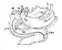 Fig. 01 - Obesity treatment and device
