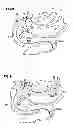 Fig. 06 - Obesity treatment and device