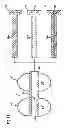 Fig. 09 - Obesity treatment and device