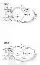 Fig. 10 - Obesity treatment and device