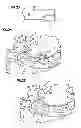 Fig. 13 - Obesity treatment and device