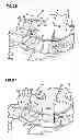Fig. 14 - Obesity treatment and device