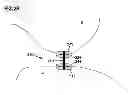 Fig. 15 - Obesity treatment and device