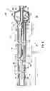 Fig. 02 - Balloon catheter