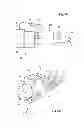 Fig. 06 - CATHETER ASSEMBLY WITH IMPROVED SAFETY MEANS