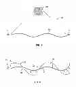 Fig. 02 - Occlusion devices and methods of their manufacture and use