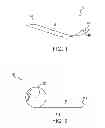Fig. 02 - Diaper closure system