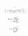 Fig. 02 - Devices and methods for transnasal dilation and irrigation of the sinuses