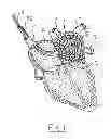 Fig. 02 - Apparatus and method for intra-cardiac mapping and ablation
