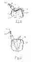 Fig. 08 - Apparatus and method for intra-cardiac mapping and ablation