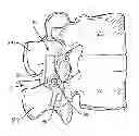 Fig. 01 - SPINOUS PROCESS IMPLANT WITH PLATE MOVEABLE BY GEAR NUT
