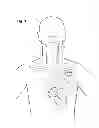Fig. 02 - Vagus nerve neurostimulator with multiple patient-selectable modes for treating chronic cardiac dysfunction
