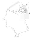 Fig. 02 - Differential neurostimulation therapy driven by physiological therapy