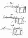Fig. 02 - Methods for implanting a subcutaneous defibrillator