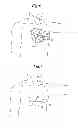 Fig. 04 - Methods for implanting a subcutaneous defibrillator