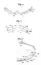 Fig. 07 - Methods for implanting a subcutaneous defibrillator