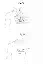 Fig. 08 - Methods for implanting a subcutaneous defibrillator