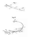 Fig. 09 - Methods for implanting a subcutaneous defibrillator