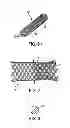 Fig. 02 - Disintegrating stent and method of making same