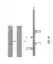 Fig. 06 - Disintegrating stent and method of making same