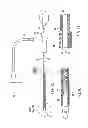 Fig. 09 - Disintegrating stent and method of making same