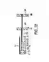 Fig. 11 - Disintegrating stent and method of making same