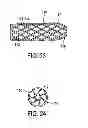 Fig. 12 - Disintegrating stent and method of making same