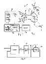 Fig. 02 - Leak-compensated pressure regulated volume control ventilation