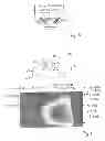 Fig. 03 - Sensor device and method