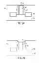 Fig. 03 - Formation of the dielectric cap layer for a replacement gate structure