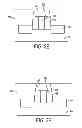 Fig. 05 - Formation of the dielectric cap layer for a replacement gate structure