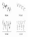 Fig. 05 - Method for motion correction in magnetic resonance imaging using radio frequency coil arrays