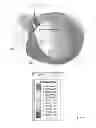 Fig. 08 - Wearable device assembly having antenna