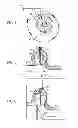 Fig. 05 - MULTI-PIECE TWIN SCROLL TURBINE
