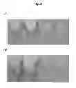 Fig. 09 - Method for regenerating hyaline cartilage