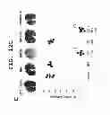 Fig. 19 - IMMUNOTHERAPEUTIC METHOD USING ARTIFICIAL ADJUVANT VECTOR CELLS THAT CO-EXPRESS CD1D AND TARGET ANTIGEN