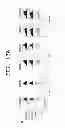 Fig. 20 - IMMUNOTHERAPEUTIC METHOD USING ARTIFICIAL ADJUVANT VECTOR CELLS THAT CO-EXPRESS CD1D AND TARGET ANTIGEN