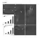 Fig. 05 - Parental Composition Comprising Microsperes with a Diameter between 10 and 20 Microns