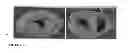 Fig. 10 - Parental Composition Comprising Microsperes with a Diameter between 10 and 20 Microns