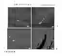 Fig. 11 - Parental Composition Comprising Microsperes with a Diameter between 10 and 20 Microns