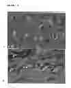 Fig. 14 - Parental Composition Comprising Microsperes with a Diameter between 10 and 20 Microns