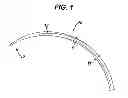 Fig. 02 - Surgical needle coatings and methods