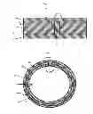 Fig. 02 - POLYSILOXANE SKINNED FLEECE